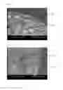 Fig. 04 - Hydrophilic matrix beadlet compositions with enhanced bioavailability