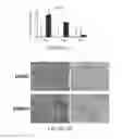 Fig. 04 - Methods of treating hepatic fibrosis and associated diseases by regulating Rev-ERB activity
