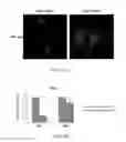 Fig. 08 - Methods of treating hepatic fibrosis and associated diseases by regulating Rev-ERB activity