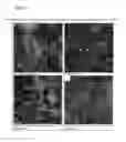 Fig. 09 - Clearance of amyloid beta