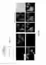 Fig. 02 - Methods of inducing read-through of a nonsense mutation associated with ataxia telangiectasia, Rett syndrome or spinal muscular atrophy by erythromycin or azithromycin