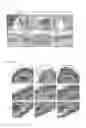 Fig. 02 - COMPOSITIONS AND METHODS COMPRISING TOLL LIKE RECEPTOR (TLR) STIMULATING AGENTS FOR PROPHYLAXIS AND THERAPY FOR DAMAGE TO DERMAL EPITHELIUM