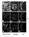Fig. 03 - METHODS AND COMPOSITIONS USING FGF-9 TO ENHANCE NEOVASCULARIZATION AND REGENERATION