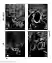 Fig. 04 - METHODS AND COMPOSITIONS USING FGF-9 TO ENHANCE NEOVASCULARIZATION AND REGENERATION
