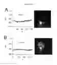 Fig. 11 - Photoactivated molecules for light-induced modulation of the activity of electrically excitable cells and methods of using same