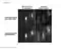 Fig. 07 - Labeling composition for cancer lesion