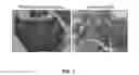 Fig. 08 - Multimodal particles, methods and uses thereof