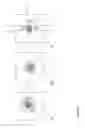 Fig. 04 - ERODIBLE EMBOLIZATION MATERIAL