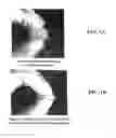 Fig. 02 - Process for demineralization of bone matrix with preservation of natural growth factors