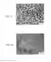 Fig. 02 - Method of treating peripheral artery diseases in lower limbs