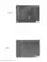 Fig. 07 - Method of reducing the risk of embolization of peripheral blood vessels