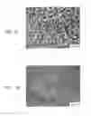Fig. 02 - Method of inhibiting thickening of vascular intima