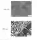 Fig. 03 - Method of inhibiting thickening of vascular intima