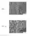 Fig. 04 - Method of inhibiting thickening of vascular intima