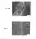 Fig. 05 - Method of inhibiting thickening of vascular intima