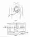 Fig. 04 - ARTIFICIAL HEART CONTROL DEVICE, ARTIFICIAL HEART SYSTEM AND ARTIFICIAL HEART CONTROL METHOD