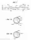 Fig. 02 - Devices and Methods for Transnasal Dilation and Irrigation of the Sinuses