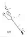 Fig. 08 - Catheter apparatus with telescoping lumen catheters and its use in methods for treating vasculatures