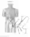 Fig. 02 - GUIDEWIRE MANIPULATION DEVICE