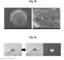 Fig. 04 - Microstructure-based drug delivery system comprising microporous structure