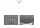 Fig. 10 - Microstructure-based drug delivery system comprising microporous structure