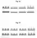 Fig. 20 - Microstructure-based drug delivery system comprising microporous structure