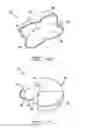 Fig. 04 - Catheter connector insert