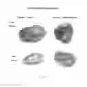 Fig. 29 - Thoracoscopic electroporation device with a suction head and with needle electrodes