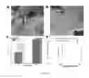 Fig. 06 - Methods of treating medical conditions by population based encoding of neural information