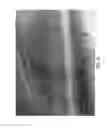 Fig. 23 - Micro blood vessels and tissue ducts
