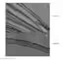 Fig. 31 - Micro blood vessels and tissue ducts