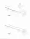 Fig. 02 - METHOD OF USING A SAFETY KNIFE, THE SAFETY KNIFE AND ITS USE