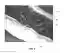 Fig. 06 - Delamination resistant, weldable and formable light weight composites