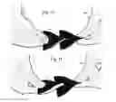Fig. 06 - Radar energy absorbing deformable low drag vortex generator