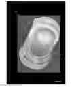 Fig. 08 - Device for dosing creams