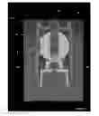 Fig. 09 - Device for dosing creams