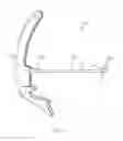 Fig. 11 - STOPPER REMOVER