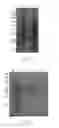 Fig. 04 - EXTRACTION METHOD FOR HYDROPHILIC RECOMBINANT PROTEIN