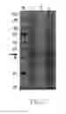 Fig. 05 - EXTRACTION METHOD FOR HYDROPHILIC RECOMBINANT PROTEIN
