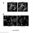 Fig. 12 - Mutant NGAL proteins and uses thereof