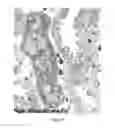 Fig. 16 - Mutant NGAL proteins and uses thereof