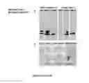 Fig. 29 - Mutant NGAL proteins and uses thereof