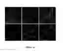 Fig. 33 - Mutant NGAL proteins and uses thereof