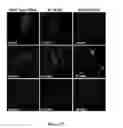 Fig. 34 - Mutant NGAL proteins and uses thereof