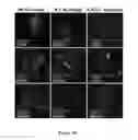 Fig. 46 - Mutant NGAL proteins and uses thereof