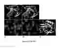 Fig. 47 - Mutant NGAL proteins and uses thereof