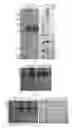 Fig. 04 - Chromatographic method for isolating and purifying high-purity recombined human serum albumin