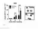 Fig. 13 - IDENTIFICATION AND USE OF NEW TUMOR-PROMOTING GENE IN HEMATOLOGICAL MALIGNANCIES