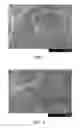 Fig. 08 - Filled polymeric materials with modified filler particles