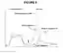 Fig. 09 - COMPOSITIONS, METHODS, AND KITS FOR PREPARING PLASMINOGEN; AND PLASMIN PREPARED THEREFROM
